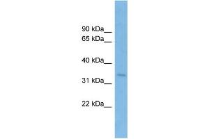 WB Suggested Anti-SSR1 Antibody Titration: 0. (SSR1 抗体  (Middle Region))
