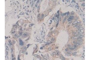 Immunohistochemistry (IHC) image for anti-Kinesin Family Member 18A (KIF18A) (AA 1-453) antibody (ABIN7436060)
