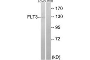 Western blot analysis of extracts from LOVO cells, using FLT3 (Ab-599) Antibody.
