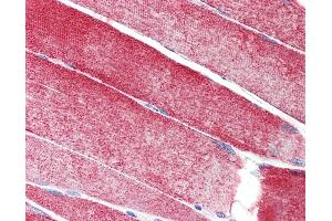 Anti-MAP3K10 / MLK2 antibody IHC staining of human skeletal muscle. (MAP3K10 抗体  (AA 110-138))