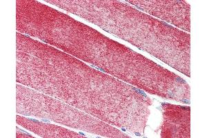 Anti-MAP3K10 / MLK2 antibody IHC staining of human skeletal muscle.