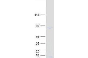 Western Blotting (WB) image for DEAD (Asp-Glu-Ala-Asp) Box Polypeptide 56 (DDX56) protein (Myc-DYKDDDDK Tag) (ABIN2719296)
