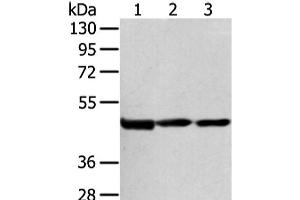 Western Blot analysis of Hela cell and Human bladder carcinoma tissue, Human normal liver tissue using AGPAT9 Polyclonal Antibody at dilution of 1/200