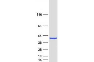 Western Blotting (WB) image for UDP-Galactose-4-Epimerase (GALE) (Transcript Variant 2) protein (Myc-DYKDDDDK Tag) (ABIN2721597)