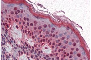 Human Skin (formalin-fixed, paraffin-embedded) stained with SIM1 antibody ABIN364478 at 5 ug/ml followed by biotinylated goat anti-rabbit IgG secondary antibody ABIN481713, alkaline phosphatase-streptavidin and chromogen. (SIM1 抗体)