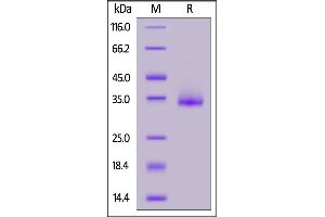 SARS-CoV-2 Spike RBD, His Tag (B. (SARS-CoV-2 Spike Protein (B.1.1.529 - Omicron, RBD) (His tag))