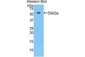 Western blot analysis of the recombinant protein. (Thymidine Phosphorylase 抗体  (AA 33-290))