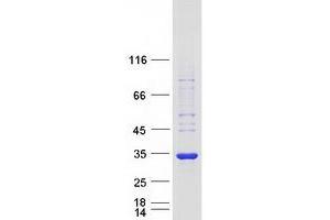 Western Blotting (WB) image for BTB (POZ) Domain-Containing Protein KCTD4 (KCTD4) protein (Myc-DYKDDDDK Tag) (ABIN2724077)