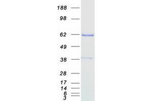 Western Blotting (WB) image for Chromatin Assembly Factor 1, Subunit B (p60) (CHAF1B) protein (Myc-DYKDDDDK Tag) (ABIN2713035)