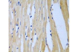 Immunohistochemistry of paraffin-embedded Rat heart using MGAT3 Polyclonal Antibody at dilution of 1:100 (40x lens). (MGAT3 抗体)