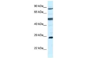 Western Blot showing AK7 antibody used at a concentration of 1 ug/ml against MCF7 Cell Lysate (Adenylate Kinase 7 抗体  (C-Term))