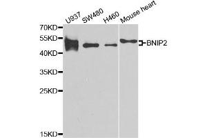 Western Blotting (WB) image for anti-BCL2/adenovirus E1B 19kDa Interacting Protein 2 (BNIP2) antibody (ABIN1980298) (BNIP2 抗体)