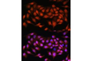 Immunofluorescence (IF) image for anti-B-Cell CLL/lymphoma 3 (BCL3) (AA 300-400) antibody (ABIN6137509)