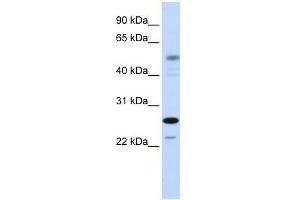 Western Blot showing PSMC3IP antibody used at a concentration of 1-2 ug/ml to detect its target protein. (PSMC3IP 抗体  (C-Term))