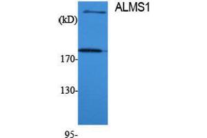 Western Blotting (WB) image for anti-Alstrom Syndrome 1 (ALMS1) (Internal Region) antibody (ABIN3173760) (ALMS1 抗体  (Internal Region))
