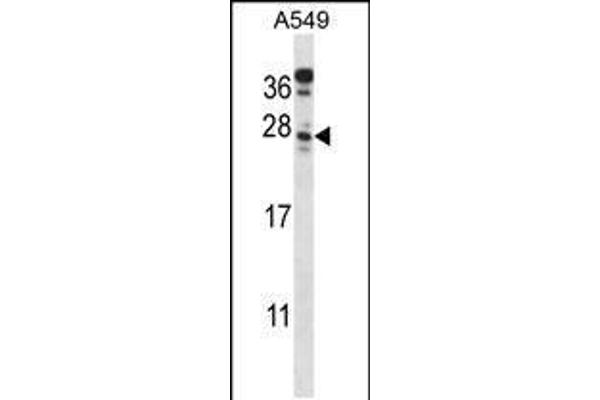 C4orf49 antibody  (C-Term)