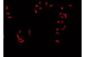 ABIN6269000 staining Jurkat  cells by IF/ICC. (Cyclin E2 抗体  (C-Term))