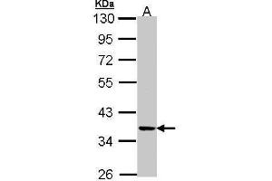WB Image Sample (30 ug of whole cell lysate) A: A431 , 10% SDS PAGE antibody diluted at 1:1000 (PRKX 抗体)