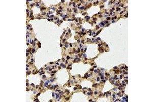 Immunohistochemical analysis of HOS staining in mouse lung formalin fixed paraffin embedded tissue section. (T-Box 5 抗体)