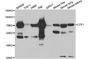 Western Blotting (WB) image for anti-Lymphocyte Cytosolic Protein 1 (LCP1) antibody (ABIN1876741) (LCP1 抗体)