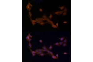 Immunofluorescence analysis of PC-12 cells using Ube2L3 / UBCH7 Rabbit mAb (ABIN7271178) at dilution of 1:25 (40x lens). (UBE2L3 抗体)