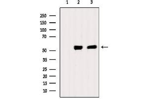 Western blot analysis of extracts from various samples, using Chk1 Antibody. (CHEK1 抗体)