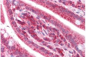 Human Small Intestine: Formalin-Fixed, Paraffin-Embedded (FFPE) (TST 抗体  (AA 101-150))