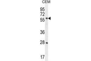 Western blot analysis in CEM cell line lysates (35ug/lane) using DLK1  Antibody . (DLK1 抗体)