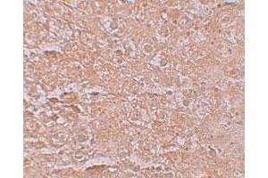 Immunohistochemical staining of mouse liver cells with SLC39A14 polyclonal antibody  at 2. (SLC39A14 抗体  (Internal Region))