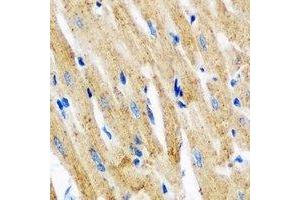 Immunohistochemical analysis of Tropomyosin 3 staining in mouse heart formalin fixed paraffin embedded tissue section. (TPM3 抗体)