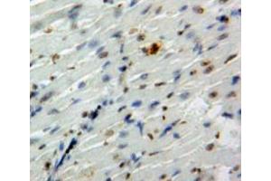 Immunohistochemistry (IHC) image for anti-POU Class 5 Homeobox 1 (POU5F1) (AA 129-352) antibody (ABIN7431773)