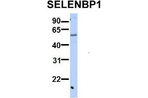 Western Blotting (WB) image for anti-Selenium Binding Protein 1 (SELENBP1) (C-Term) antibody (ABIN2783295)