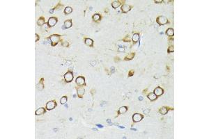 Immunohistochemistry of paraffin-embedded rat brain using PDPK1 antibody (ABIN3022351, ABIN3022352, ABIN3022353, ABIN1681308 and ABIN6218755) at dilution of 1:200 (40x lens). (PDPK1 抗体  (AA 150-429))