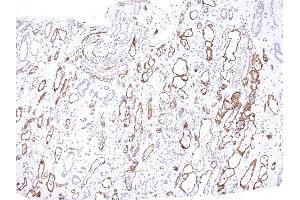 Formalin-fixed, paraffin-embedded human Kidney Transplant stained with Complement 4d Mouse Monoclonal Antibody (C4D204). (C4A 抗体)