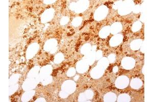 IHC testing of FFPE human bone marrow with Transferrin Receptor / CD71 antibody (clone TFRC/1817).