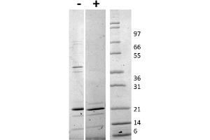 SDS-PAGE of Human TRAIL Recombinant Protein SDS-PAGE of Human TRAIL Recombinant Protein. (TRAIL 蛋白)