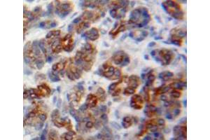 Used in DAB staining on fromalin fixed paraffin-embedded pancreas tissue (GP2 抗体  (AA 300-505))