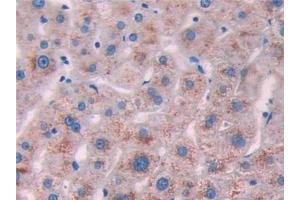 Detection of IL10Ra in Human Liver Tissue using Polyclonal Antibody to Interleukin 10 Receptor Alpha (IL10Ra) (IL-10RA 抗体  (AA 132-235))