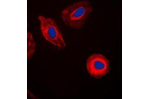 Immunofluorescent analysis of EIF4G2 staining in HeLa cells. (EIF4G2 抗体  (N-Term))