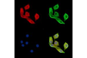 Estrogen-induced gene 121 protein Antibody staining Hela cells by IF/ICC. (ELAPOR1 抗体)