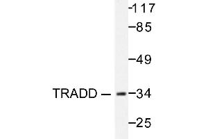 Image no. 1 for anti-TNFRSF1A-Associated Via Death Domain (TRADD) antibody (ABIN271966) (TRADD 抗体)