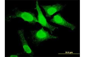 Immunofluorescence of monoclonal antibody to TOP3B on HeLa cell. (TOP3B 抗体  (AA 1-862))