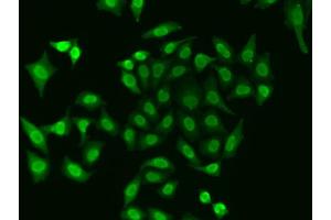 Immunofluorescence analysis of A549 cell using APEX1 antibody. (APEX1 抗体)