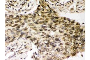 IHC analysis of Chk2 using anti-Chk2 antibody (ABIN3043811).