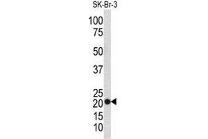 Western blot analysis of TAGLN antibody (N-term) in SK-Br-3 cell line lysates (35ug/lane). (Transgelin 抗体  (N-Term))