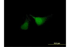 Immunofluorescence of monoclonal antibody to ANKRD37 on HeLa cell. (ANKRD37 抗体  (AA 1-158))