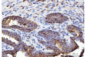 IHC analysis of ERP29 using anti-ERP29 antibody (ABIN7601342). (ERP29 抗体  (AA 33-196))