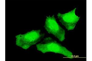 Immunofluorescence of monoclonal antibody to CTNNB1 on HeLa cell. (CTNNB1 抗体  (AA 682-781))