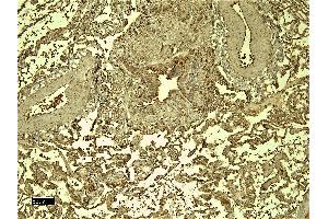 (ABIN184738) (6 μg/mL) staining of paraffin embedded Human Lung.