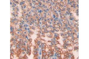 Used in DAB staining on fromalin fixed paraffin- embedded stomach tissue (OSTM1 抗体  (AA 124-277))